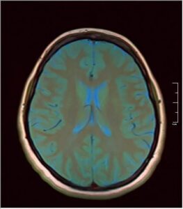 TEMPORAL ANOMALY: Déjà Vu: The Memory Leak in Your Brain
